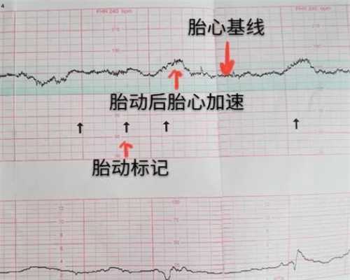 女性健美别闯误区