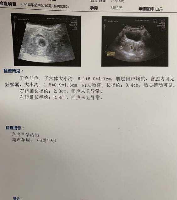 哈尔滨供卵试管婴儿多少钱？